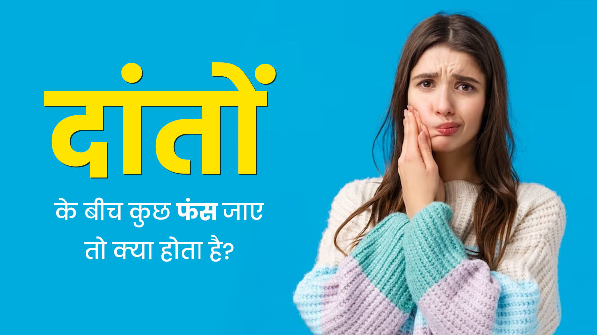 दांतों में फंसी चीज को लंबे समय तक न निकालने से क्या होता है? एक्सपर्ट से जानें