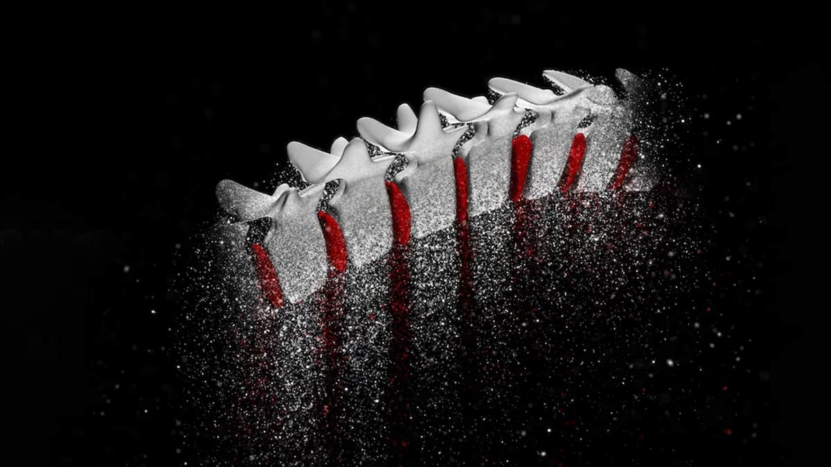 Bone Health: Here’s How You Can Identify That Your Bones Are Weak