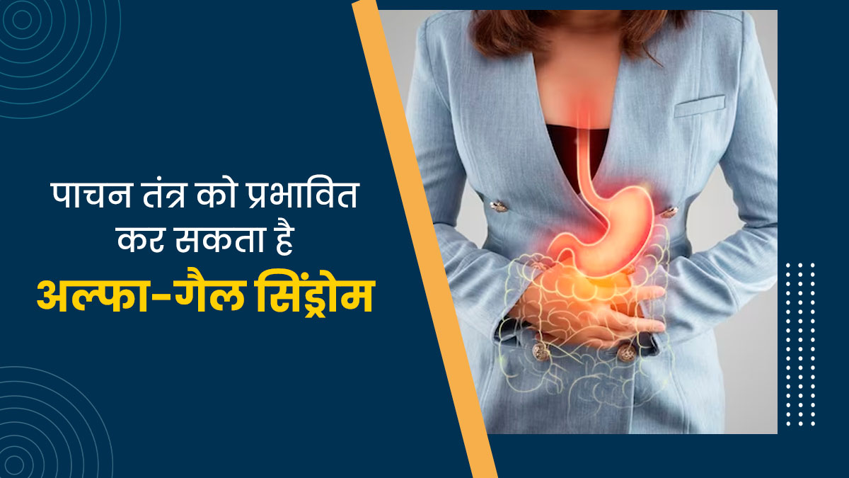 पाचन तंत्र को प्रभावित कर सकता है अल्फा गैल सिंड्रोम, जानें इसके लक्षण और कारण 
