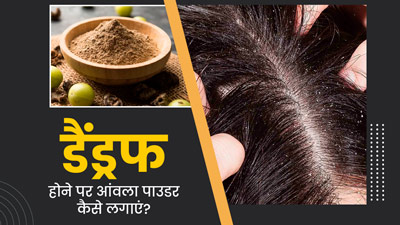 डैंड्रफ से परेशान हैं, तो इन तरीकों से करें आंवला पाउडर का इस्तेमाल, दूर हो जाएगी रूसी और खुजली