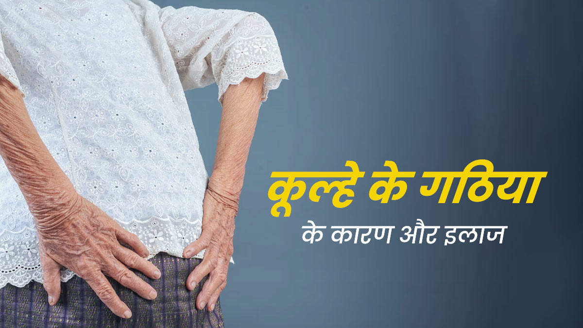 कूल्हे में गठिया (Hip Arthritis) क्यों होता है? जानें इसके कारण और इलाज 
