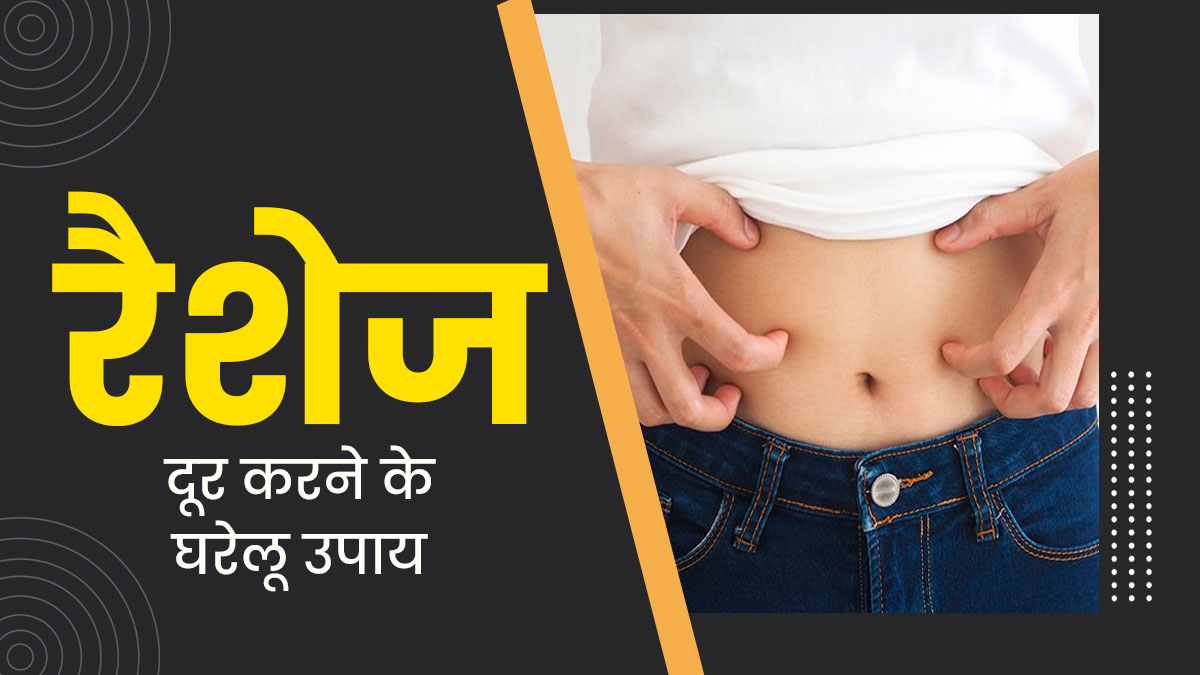 पेट के न‍िचले ह‍िस्‍से में हो गए हैं रैशेज, तो जानें कारण और राहत के ल‍िए अपनाएं ये 5 घरेलू उपाय 