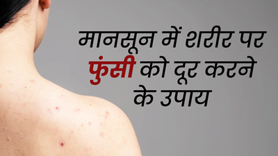 मानसून में फोड़े-फुंसी होने पर अपनाएं ये 5 घरेलू उपाय, दूर हो जाएंगे दाने और रेडनेस