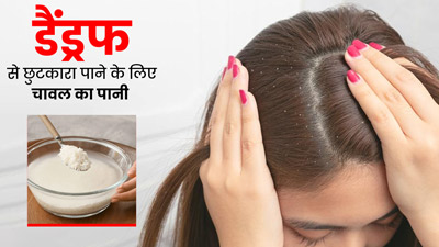 डैंड्रफ से छुटकारा पाने के लिए चावल के पानी का इस्तेमाल कैसे करें? जानें 4 तरीके, दूर होगी रूसी और खुजली