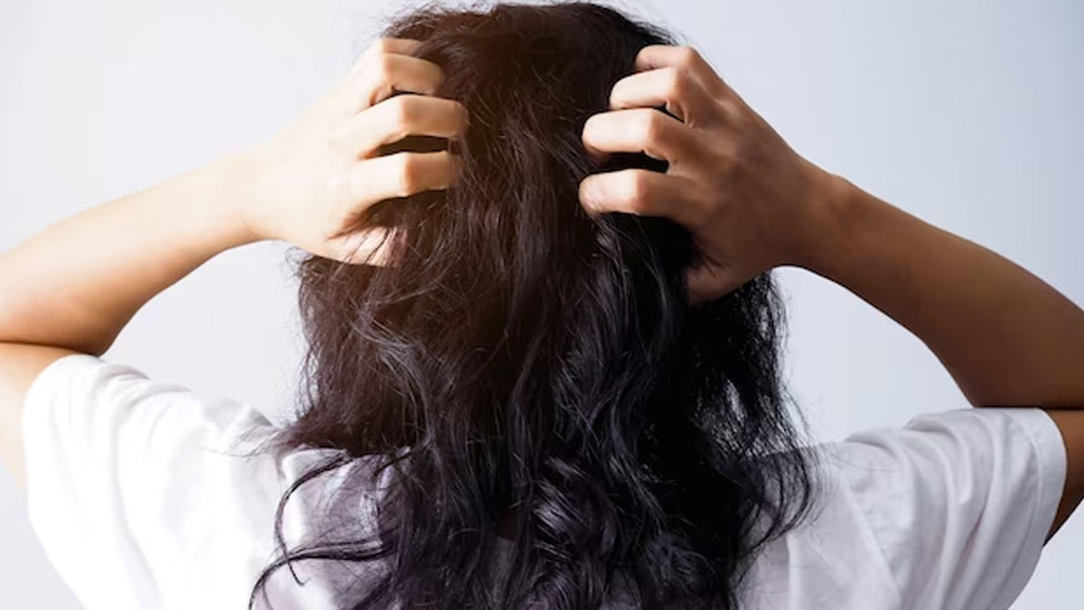 सिर की खुजली से हैं परेशान, तो राहत के ल‍िए अपनाएं डॉक्‍टर के सुझाए ये 5 ट‍िप्‍स 