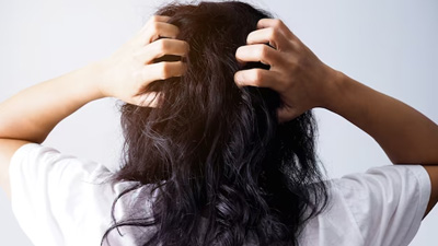सिर की खुजली से हैं परेशान, तो राहत के ल‍िए अपनाएं डॉक्‍टर के सुझाए ये 5 ट‍िप्‍स 