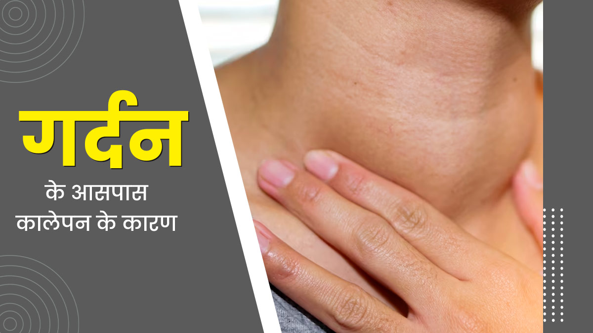 गर्दन के आसपास कालापन क्यों होता है? एक्सपर्ट से जानें कारण