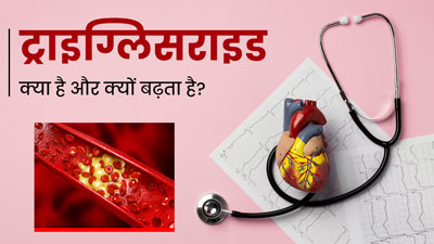 हाई ट्राइग्लिसराइड कैसे कम करें? एक्सपर्ट से जानें इसे कम करने के 5 घरेलू उपाय