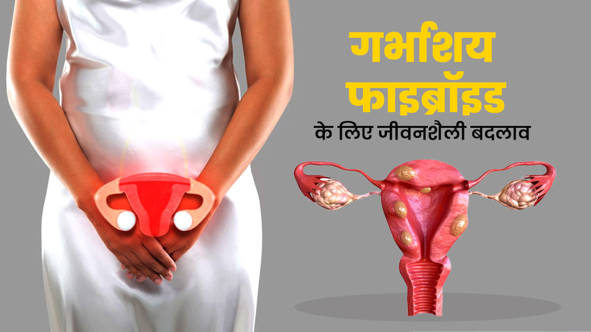 गर्भाशय फाइब्रॉइड (बच्चे दानी में गांठ) से बचाव के लिए अपनी लाइफस्टाइल में करें ये 5 बदलाव
