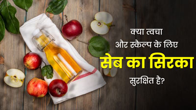 क्या स्किन और स्कैल्प पर एप्पल साइडर विनेगर (ACV) का सीधे इस्तेमाल करना सही है? जानें एक्सपर्ट से 