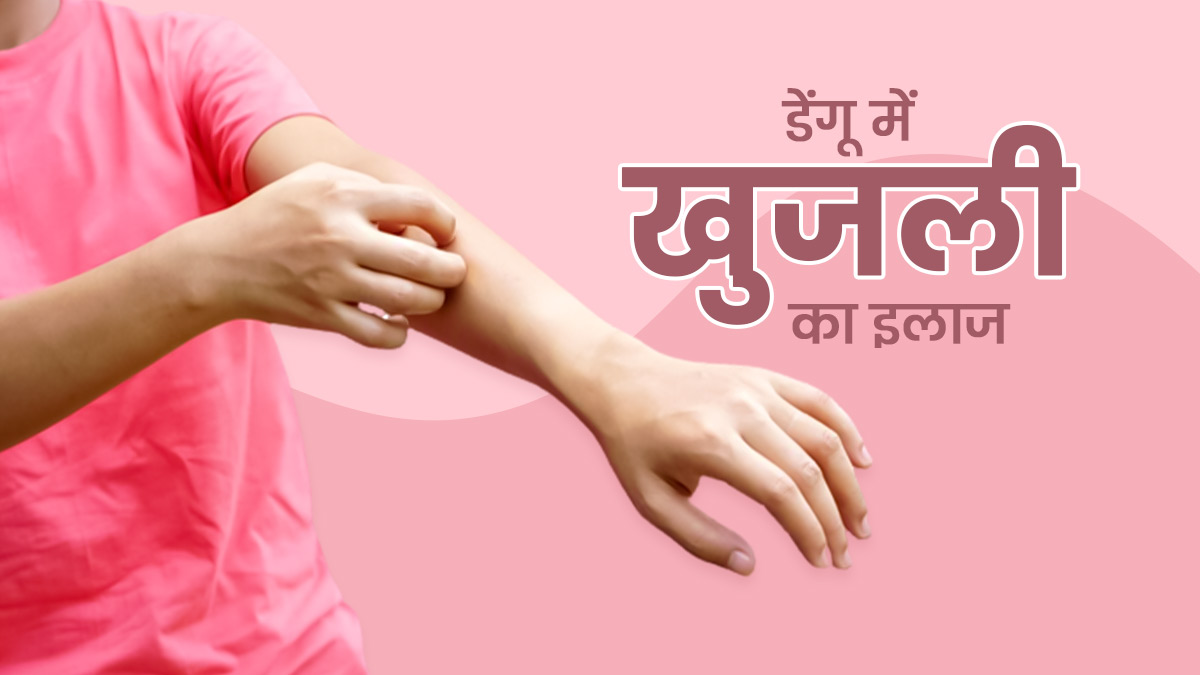 Dengue Itching: डेंगू में खुजली हो तो क्या करें? डॉक्‍टर से जानें 5 उपाय, जिनसे म‍िलेगी जल्द राहत   