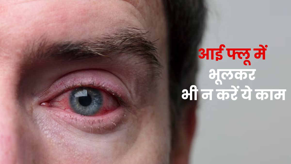 आई फ्लू होने पर भूलकर भी न करें इन घरेलू नुस्खों का इस्तेमाल, आंखों को पहुंच सकता है नुकसान