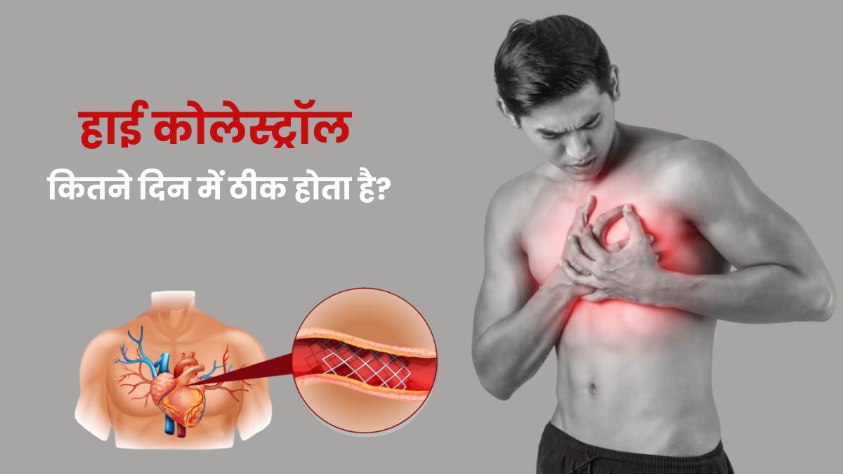 कोलेस्ट्रॉल कितने दिन में ठीक होता है? डॉक्टर से जानें कंट्रोल करने के टिप्स