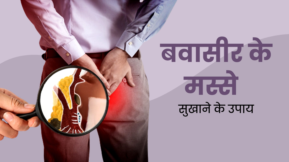 बवासीर के मस्से सुखाने के लिए आजमाएं ये प्राकृतिक तरीके, मिलेगा फायदा
