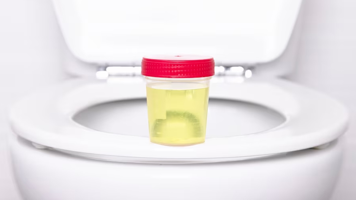 What Does It Mean If Your Urine Is Cloudy Doctor Answers OnlyMyHealth