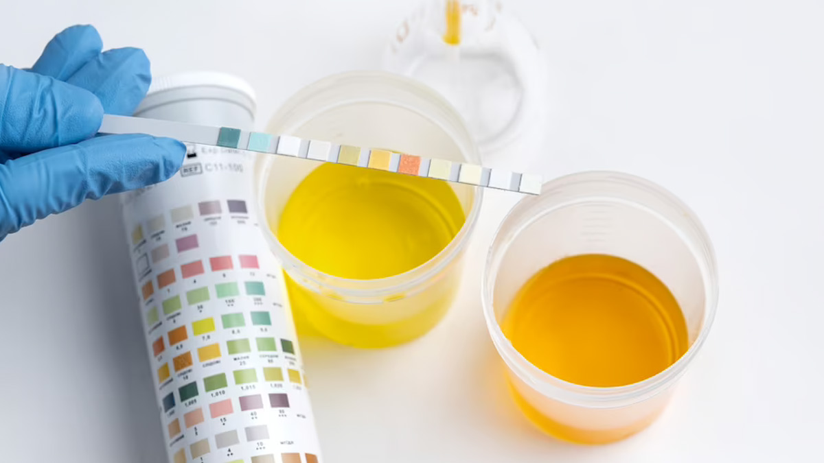 What the color of your urine says about your hydration