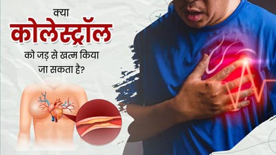 क्या कोलेस्ट्रॉल को जड़ से खत्म किया जा सकता है? डॉक्टर से जानें जवाब