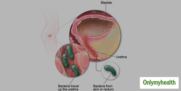 Urinary Infections In Older Adults