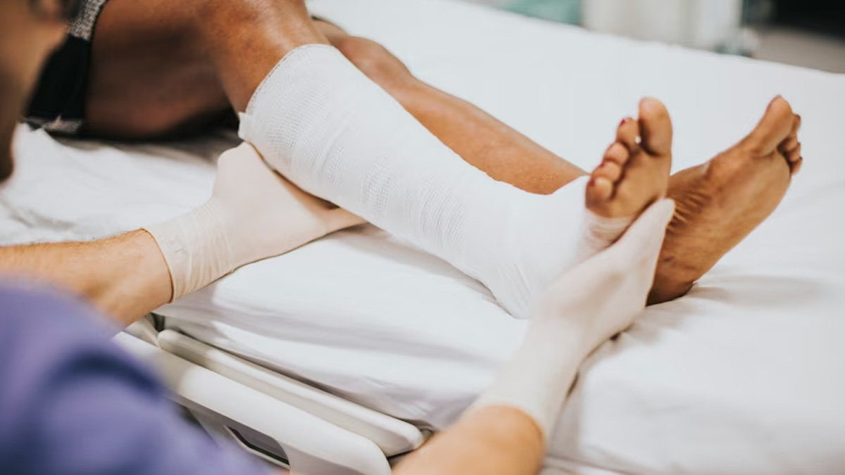 Healing A Fracture Quickly