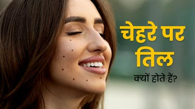 चेहरे पर तिल क्यों होते हैं? डॉक्टर से जानें इसके कारण और बचाव के टिप्स