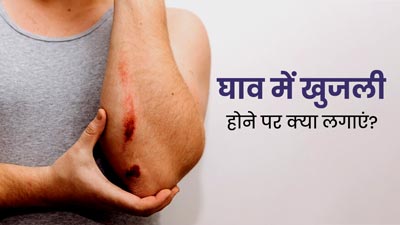घाव सूखने के बाद शुरू हो गई खुजली? छुटकारा पाने के लिए अपनाएं ये 5 तरीके, मिलेगा आराम