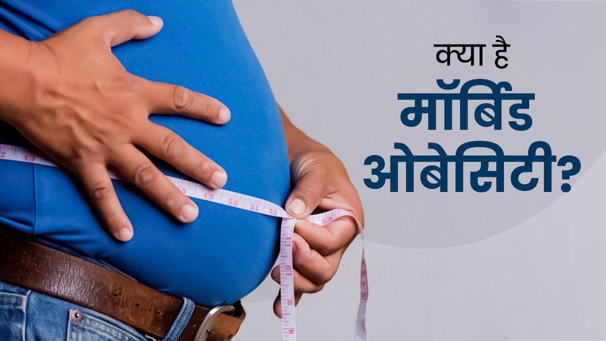 35 से ज्‍यादा बीएमआई देता है मॉर्बिड ओबेसिटी का संकेत, जानें इस कंडीशन का कारण और इलाज