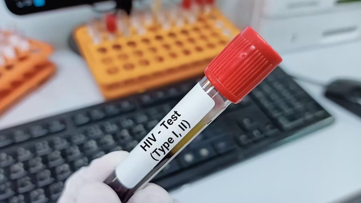 tests to detect the early stage of AIDS