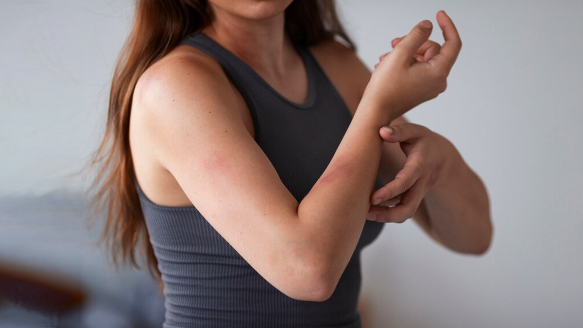 Allergic Reactions