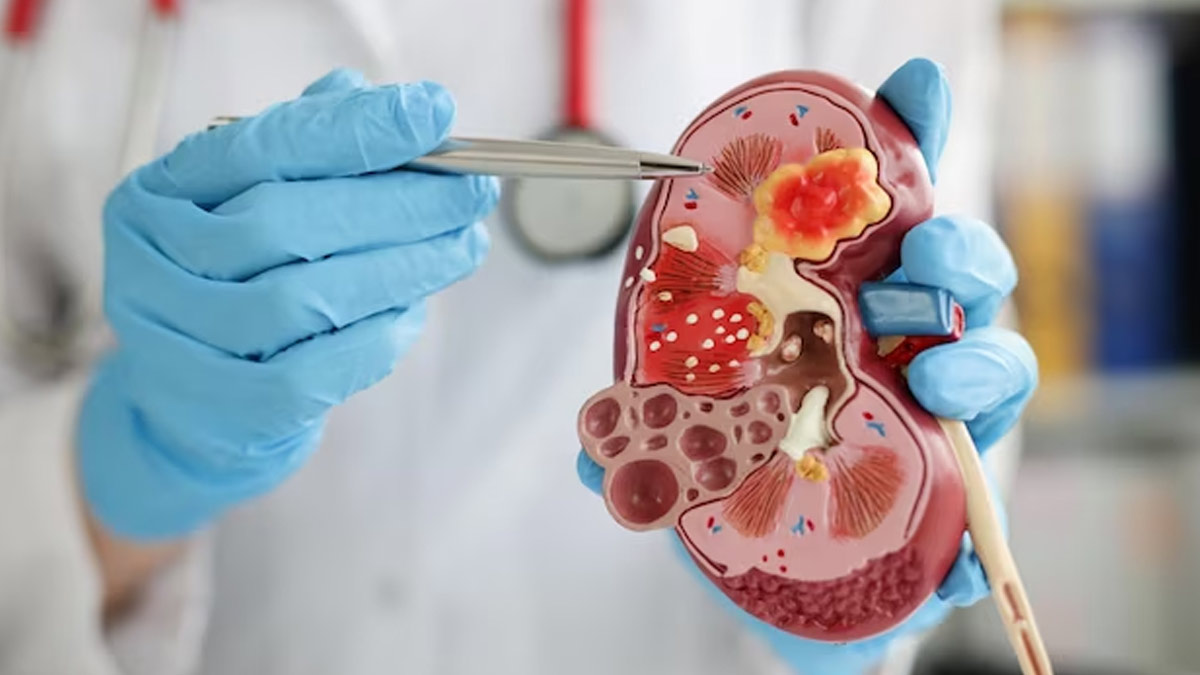 Did You Find Blood In Urine? Here’s What It Indicate