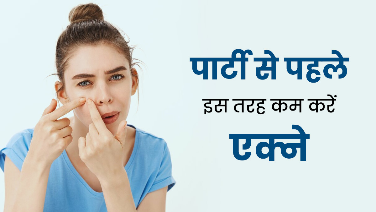 पार्टी में जाना है और चेहरे पर हैं मुंहासे? इन 8 टिप्स को अपनाकर पाएं इससे तुरंत राहत