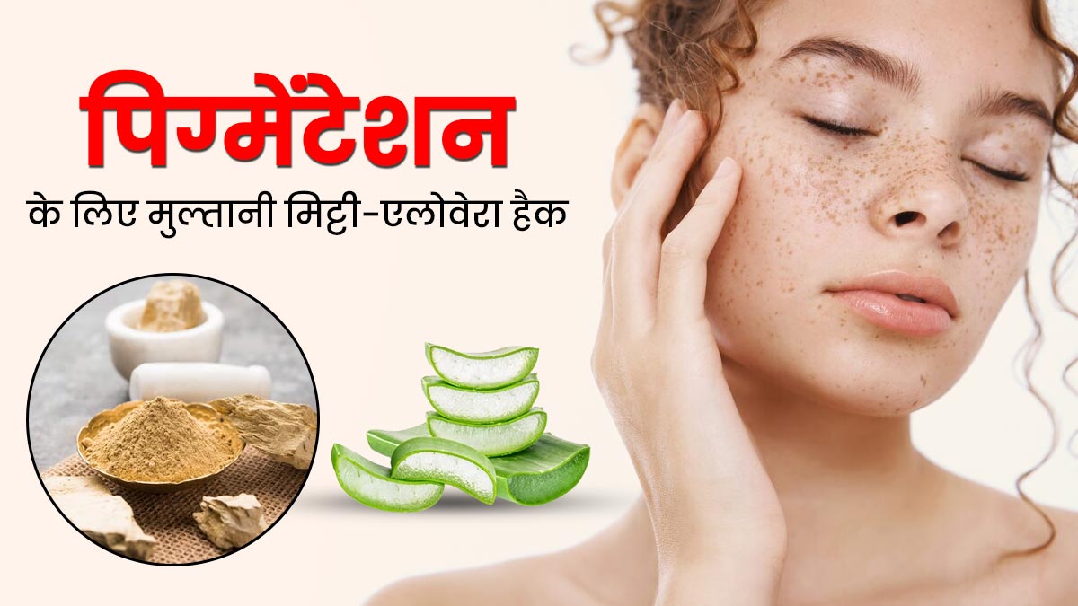 डार्क स्पॉट्स और पिग्मेंटेशन दूर करने के लिए इस्तेमाल करें मुल्तानी मिट्टी और एलोवेरा का ये हैक 