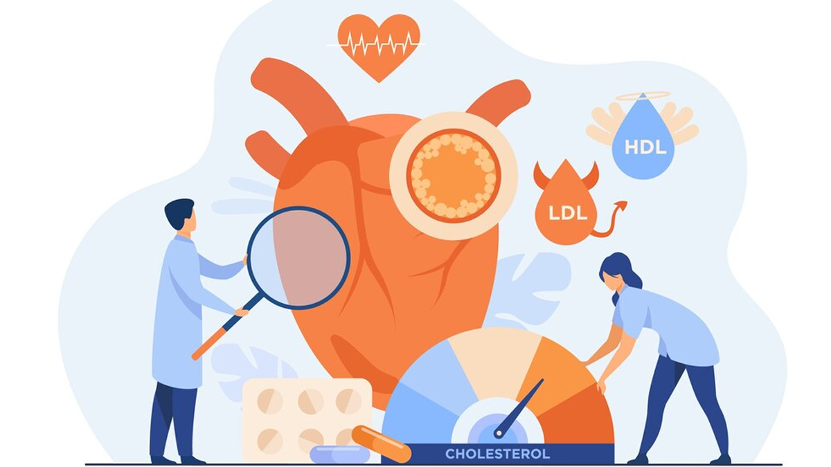 high-cholesterol