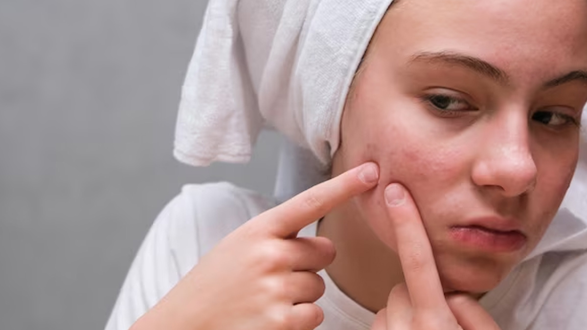 SKIN CARE