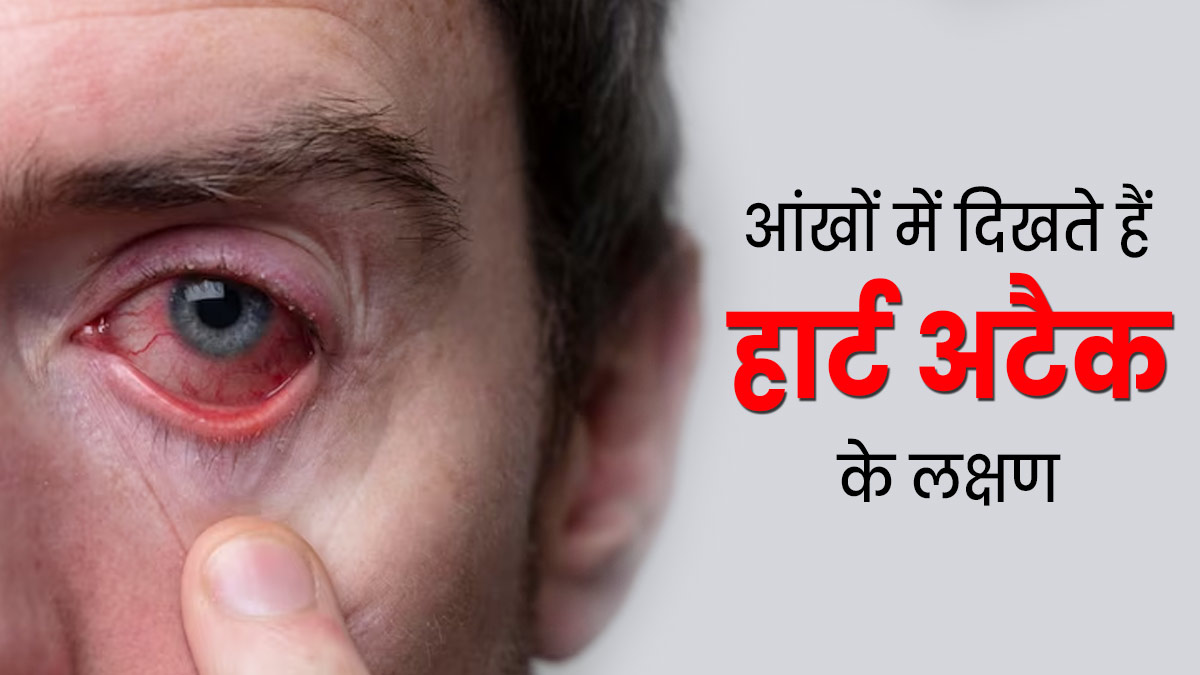 आंखों में दिखते हैं हार्ट अटैक के लक्षण, सही समय पर पहचान लेने से बच सकती है जान