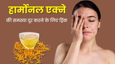 रोज पिएं मेथी, दालचीनी और काली किशमिश का पानी, दूर हो जाएगी हार्मोनल एक्ने की समस्या