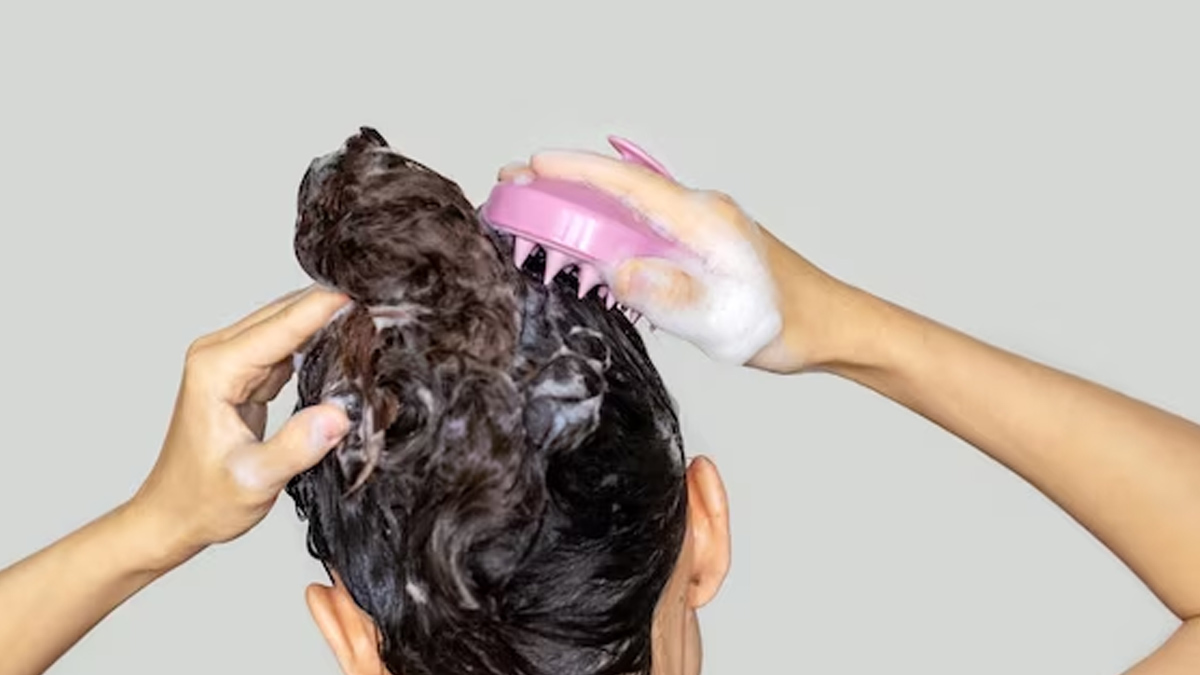 scalp-treatment