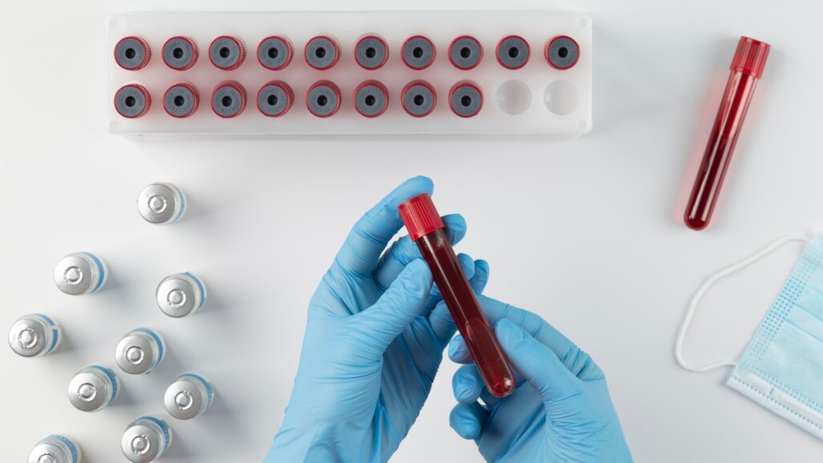 Frequent Low Hemoglobin Causes