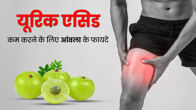 यूरिक एसिड कम करने के लिए करें आंवले का सेवन, तेजी से मिलेगा फायदा