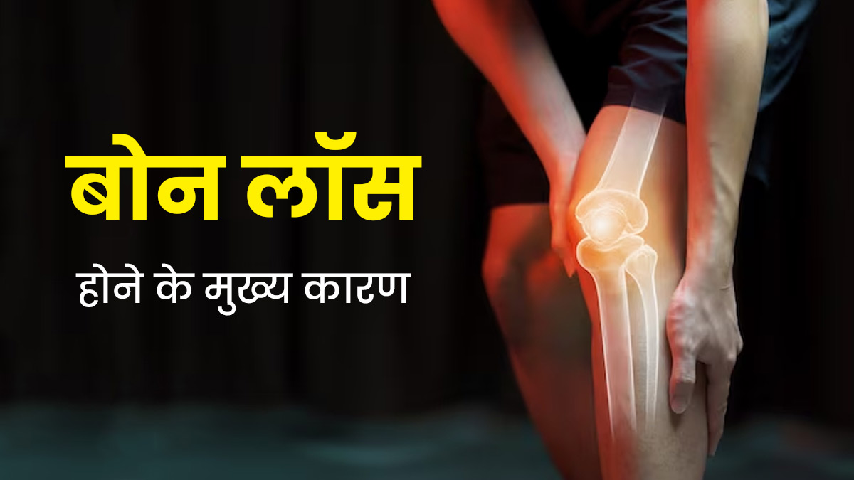  बोन लॉस क्यों होता है? एक्सपर्ट से जानें इसके मुख्य कारण
