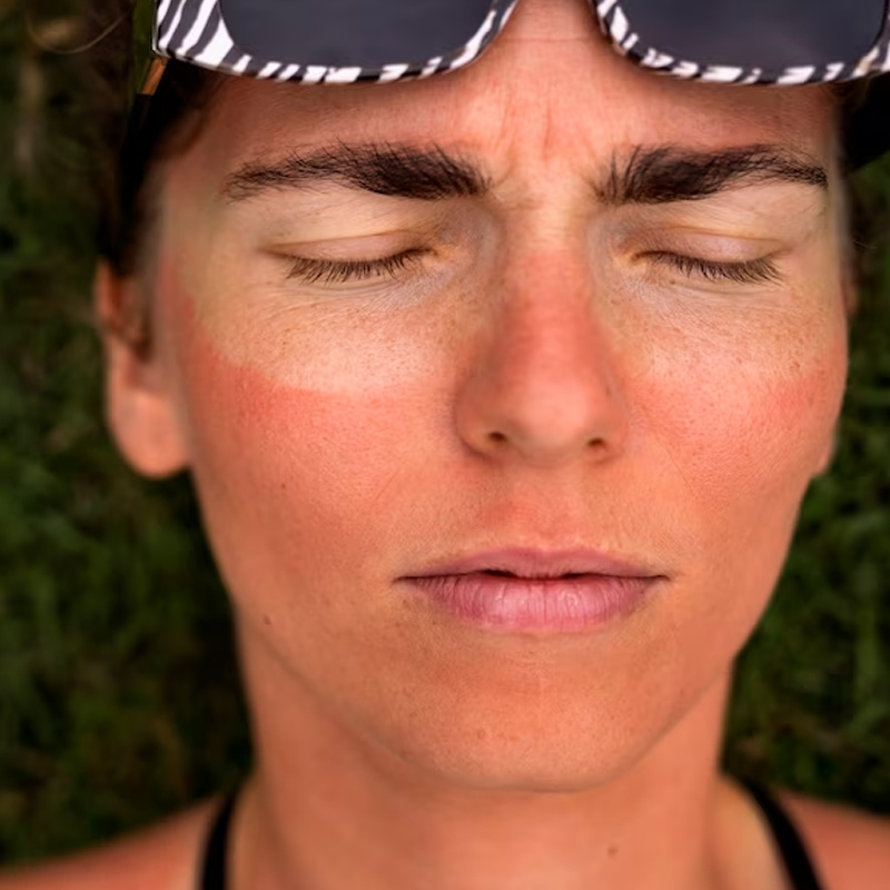 Don't Throw Away Tea Bags 8 Ways To Use Tea Bags For Health And