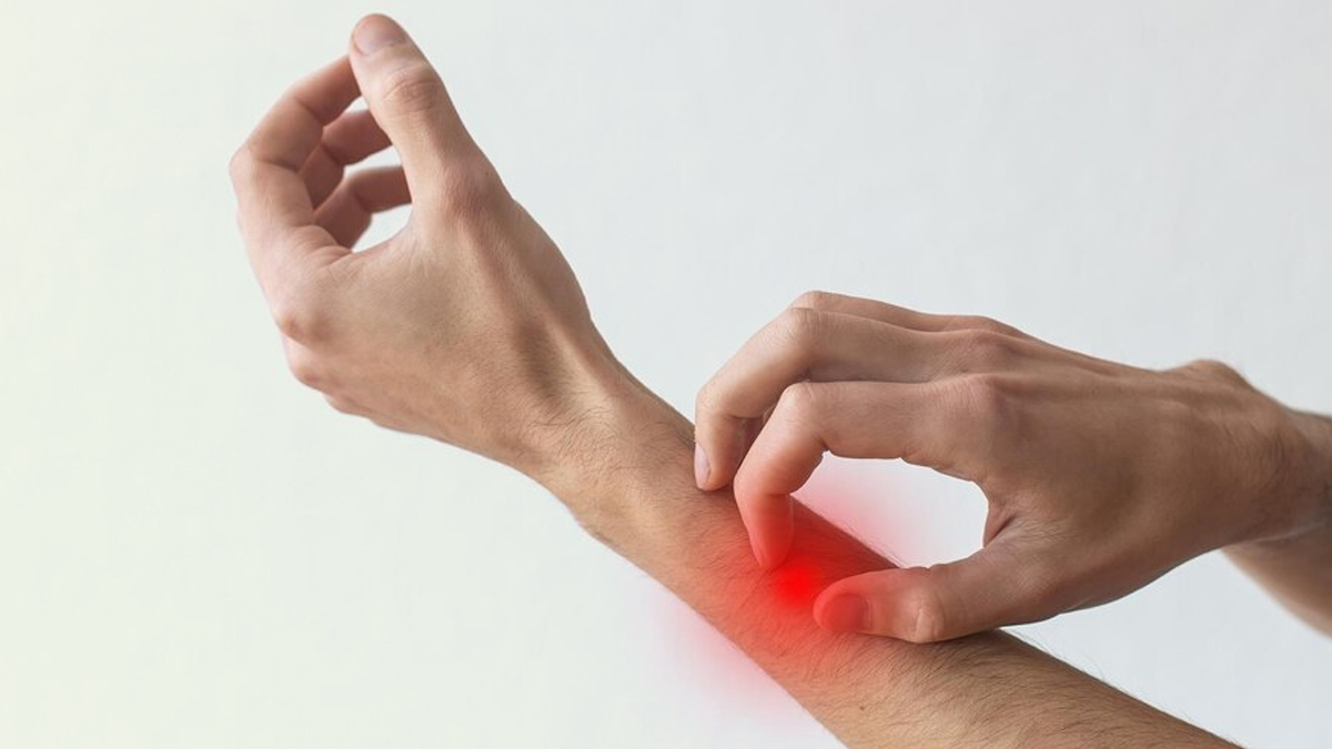 Can Psoriasis Patient Eat Sugar In Hindi