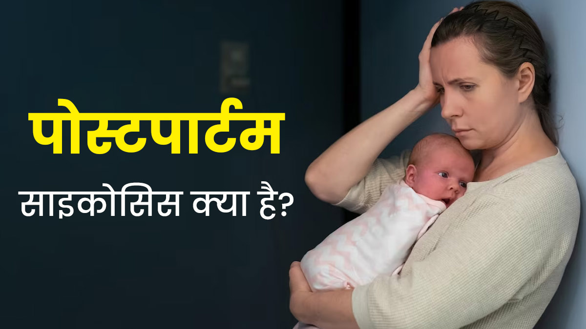 पोस्टपार्टम साइकोसिस क्‍या है? डॉक्‍टर से जानें इसके लक्षण, कारण और इलाज 