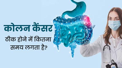 कोलन कैंसर ठीक होने में कितना समय लगता है? जानें इसका इलाज