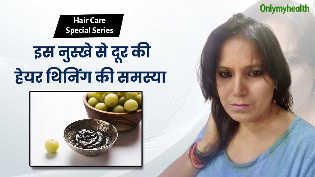 हेयर थिनिंग होने पर अपनाएं मेरी मां का बताया यह नुस्‍खा, पहली ही बार में महसूस होता है फर्क 