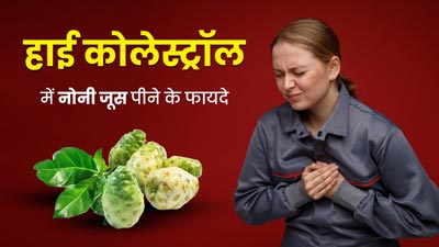 हाई कोलेस्ट्रॉल कम करने के लिए पिएं नोनी का जूस, मिलेंगे जबरदस्त फायदे