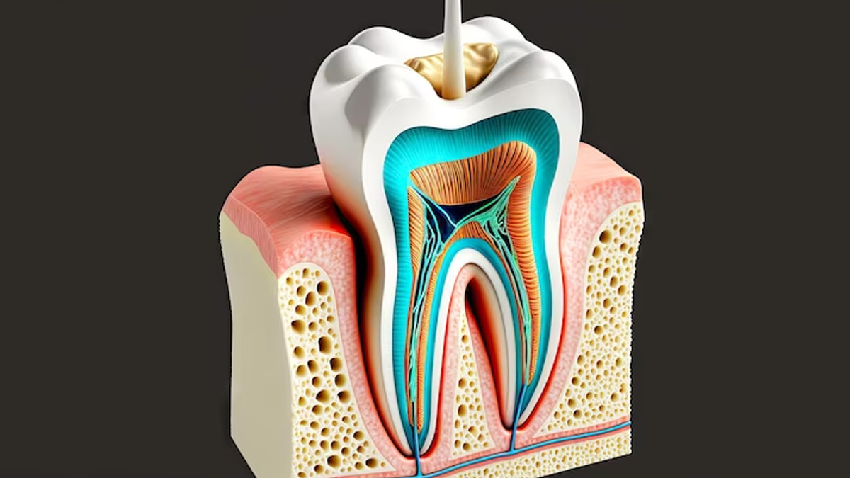 root canal treatment