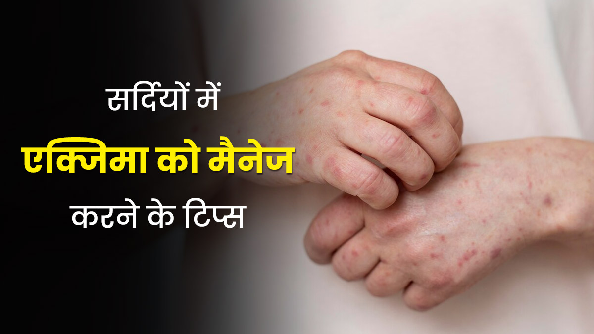 सर्दियों में एक्जिमा के कारण बढ़ गई है खुजली और जलन? राहत के लिए अपनाएं ये 5 उपाय