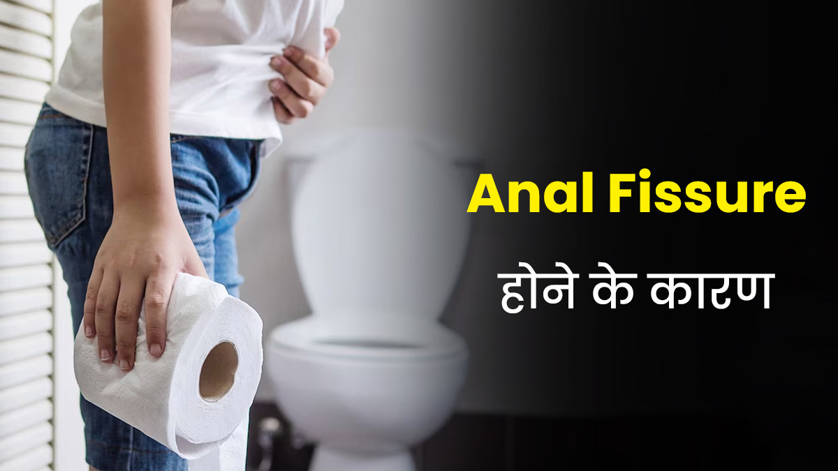 Anal Fissure: फिशर क्यों होता है? डॉक्टर से जानें इसके 5 बड़े कारण और बचाव के उपाय