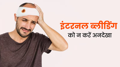 एक्सिडेंट के बाद अस्पताल जाने से किया मना, Internal Bleeding के कारण शख्स की मौत, जानें क्यों है ये खतरनाक