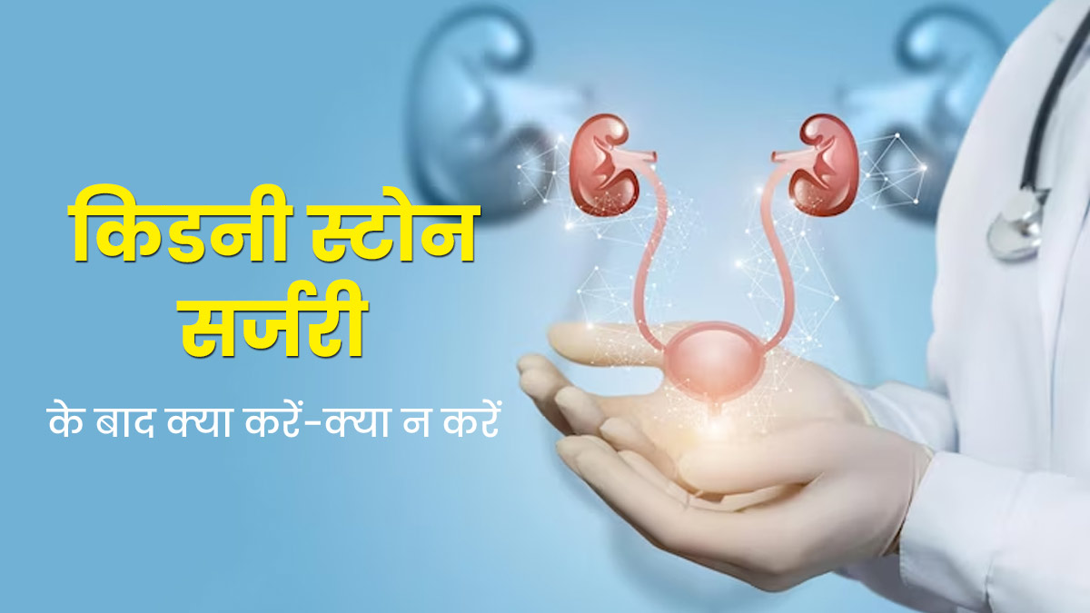 किडनी स्टोन की सर्जरी कराने के बाद क्या करें और क्या न करें? जानें जरूरी बातें